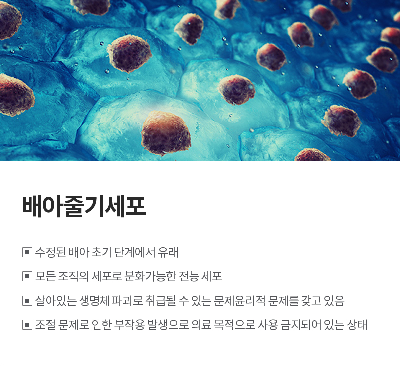 줄기세포2개2